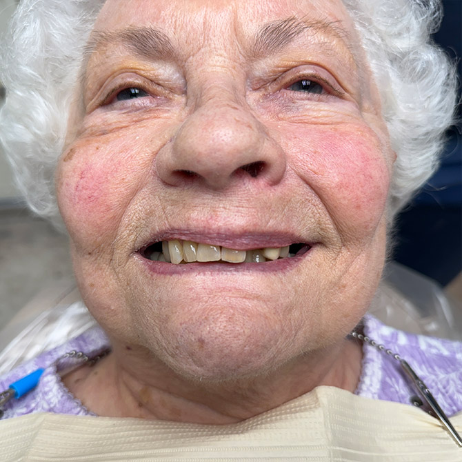 before-patient1
